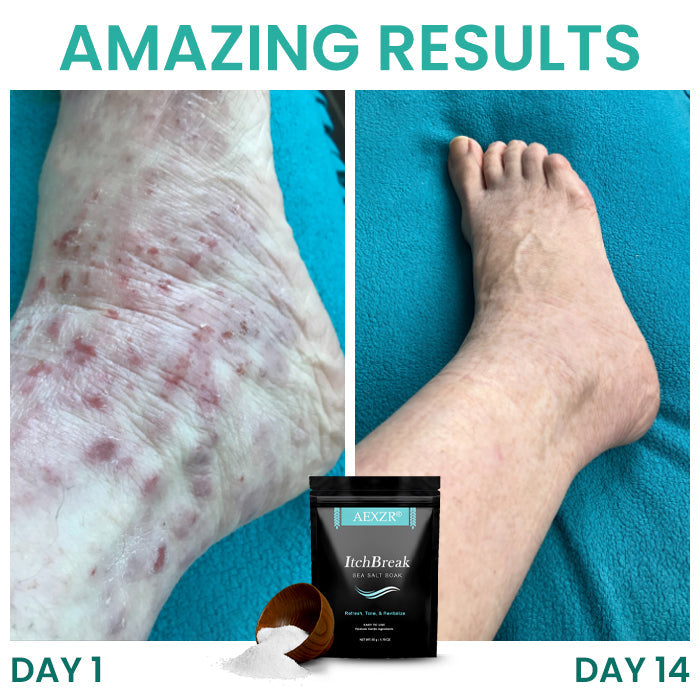 AEXZR® ItchBreak Sea Salt Soak