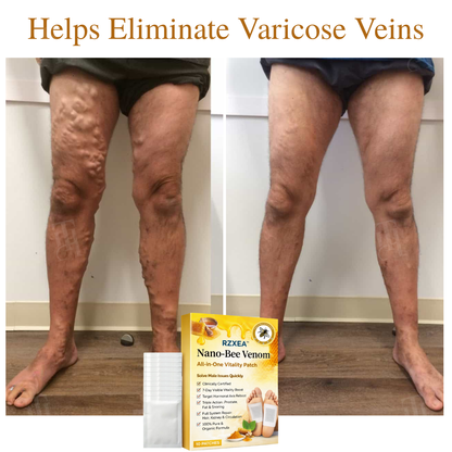 RZXEA™ Nano-Bee Venom All-in-One Vitality Patch
