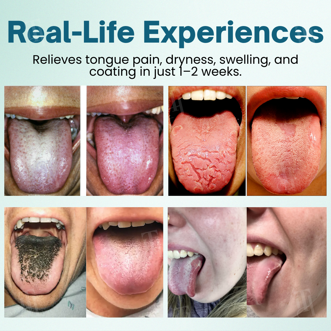 RZXEA™ ProShield Tongue Restore Spray