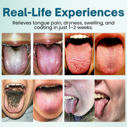 RZXEA™ ProShield Tongue Restore Spray