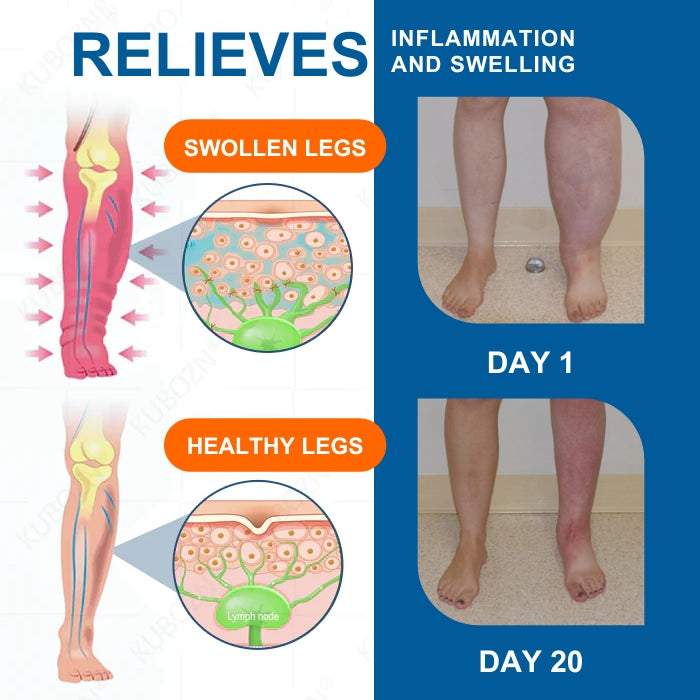 AEXZR® LYMPHEDEMA Drainage Massage Cream